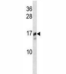 TRAPPC2 Antibody