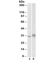Western blot testing of mouse and rat spinal cord lysates with HOXA9 antibody at 1ug/ml. Predicted m