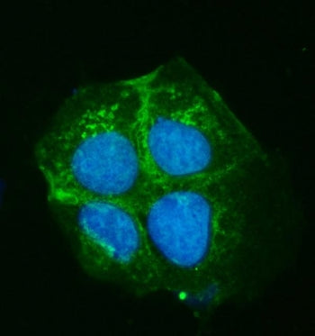 ATP7B Antibody