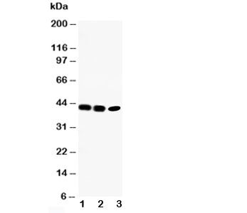 CCR6 Antibody