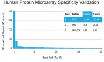 Analysis of HuProt(TM) microarray containing more than 19,000 full-length human proteins using Fibro