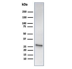 Western blot testing of human liver tissue lysate using recombinant HSP27 antibody (clone HSPB1/6490