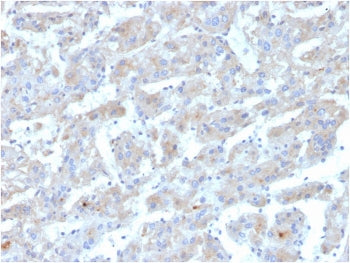 IHC staining of FFPE human liver with APOB antibody. HIER: boil tissue sections in pH 9 10mM Tris wi