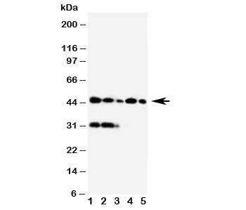Haptoglobin Antibody