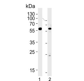 Western blot testing of human 1) HepG2 and 2) HL60 cell lysate with FANCC antibody. Predicted molecu