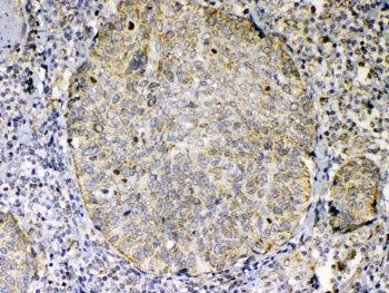 GITRL Antibody / TNFSF18