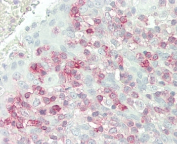 IHC testing of FFPE human tonsil tissue with FKBP10 antibody. HIER: steam section in pH6 citrate buf