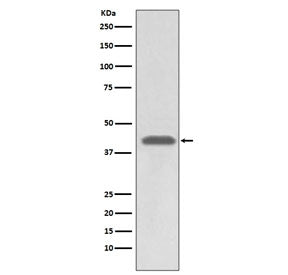 HLA-A Antibody