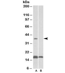 CD57 Antibody