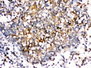 CD153 Antibody