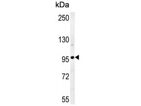 GIT1 Antibody / p95-APP1