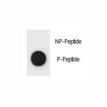 Dot blot analysis of phospho-TSC1 antibody. 50ng of phos-peptide or nonphos-peptide per dot were spo
