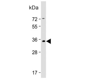 PRRT2 Antibody