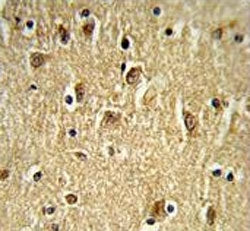 FAK Antibody / Focal Adhesion Kinase / PTK2