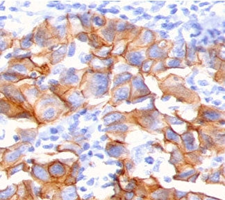 Neuregulin-1 Antibody / NRG1