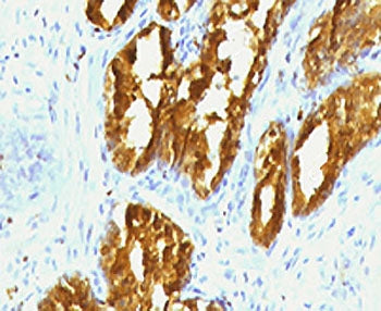 PSAP Antibody / Prostate Specific Acid Phosphatase