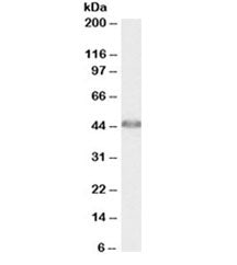 ACAT1 Antibody