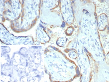 IHC staining of FFPE human placental tissue with Matrix metalloproteinase 2 antibody (clone MMP2/458
