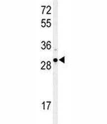 XBP1 Antibody
