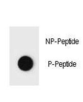 PTEN Antibody (phospho-T382)