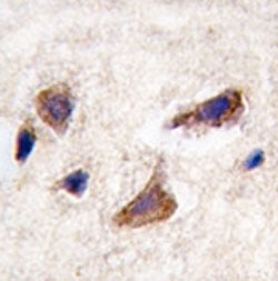 CAMKK2 Antibody