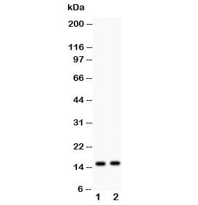 Western blot testing of FABP5 antibody and Lane 1) human HeLa and 2) HEPG2 lysate; Predicted molecul