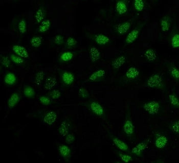Immunofluorescent staining of FFPE human HeLa cells with PIN1 antibody (green). HIER: steam section 