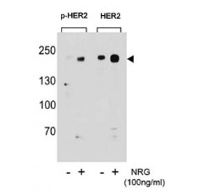 HER2 Antibody (ERBB2) (phospho-S1151)