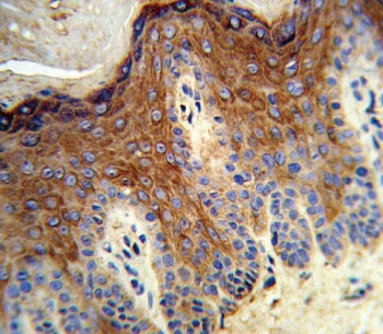 12 Lipoxygenase Antibody / ALOX12