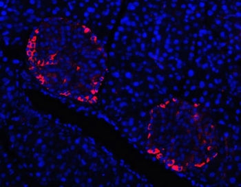 Immunofluorescent staining of FFPE mouse pancreas tissue with TTR antibody (red) and DAPI nuclear st