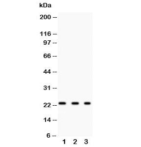 Western blot testing of GST pi antibody and lysate from: 1) rat kidney; 2) human HeLa; 3) human COLO
