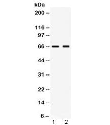 Western blot testing of human 1) MCF7 and 2) MM453 lysate with Nectin-4 antibody at 0.5ug/ml. Expect