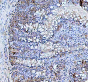 BCMA Antibody / CD269 / TNFRSF17