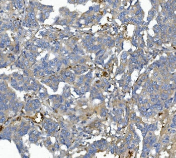AFM Antibody / Afamin
