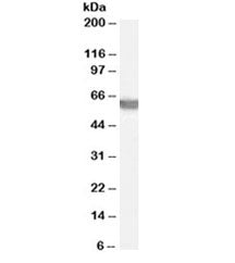 Western blot testing of human testis lysate with G6PD antibody at 0.03ug/ml. Predicted molecular wei