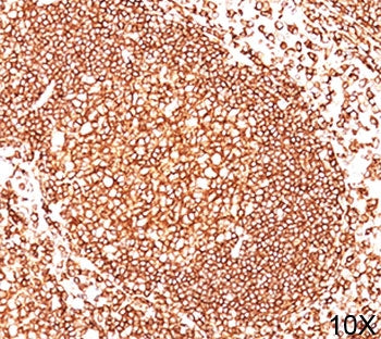IHC testing of human tonsil (10X) stained with CD45 antibody cocktail (2B11 + PD7/26).