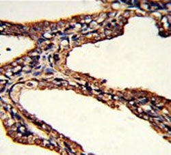PSMB9 Antibody / Proteasome subunit beta type-9