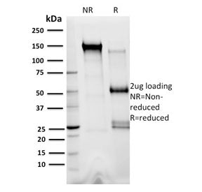 XRCC3 Antibody