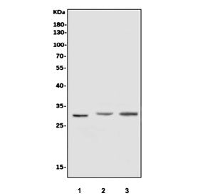 Superoxide Dismutase 3 Antibody / SOD3