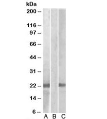 Western blot testing of HEK293 lysate overexpressing human CST8-MYC probed with Cystatin 8 antibody 