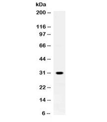Western blot testing of rat skeletal muscle lysate with ZWINT antibody at 0.5ug/ml. Expected molecul