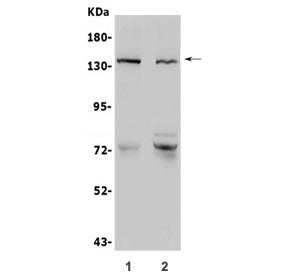 Western blot testing of human 1) LNCaP and 2) SGC-7901 lysate with CDH2 antibody. Predicted molecula