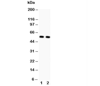 GLUT4 Antibody (Glucose Transporter 4)