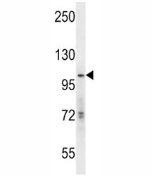 GCN5 Antibody