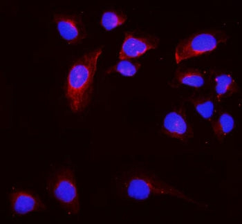 CD168 Antibody / HMMR