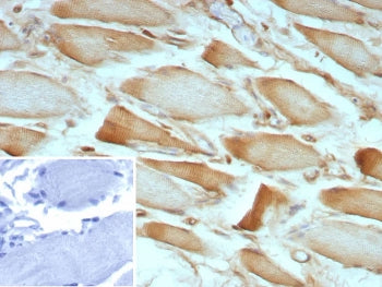 IHC staining of FFPE human skeletal muscle tissue with ZNF408A antibody (clone ZNF804A/8945). Inset: