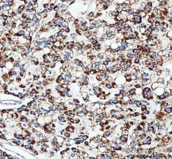 TFAM Antibody