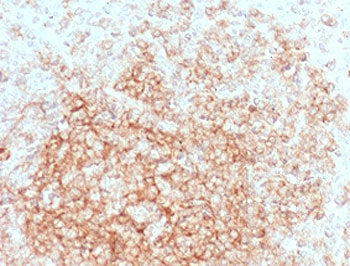 CD21 Antibody