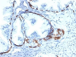 IHC staining of FFPE human prostate tissue with CK14 antibody (clone KRT14/6957). HIER: boil tissue 