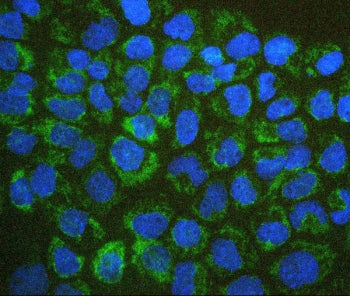 BAK1 Antibody